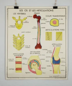 Scout Vintage French School Science Poster- Joints And Fractures