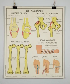 Scout Vintage French School Science Poster- Joints And Fractures